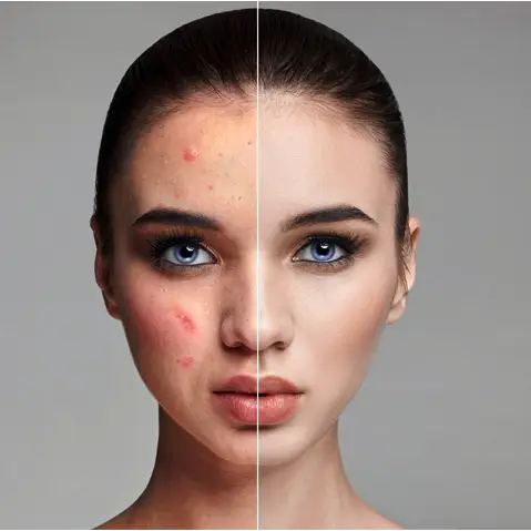 Professional Photo Retouching Services in Germany